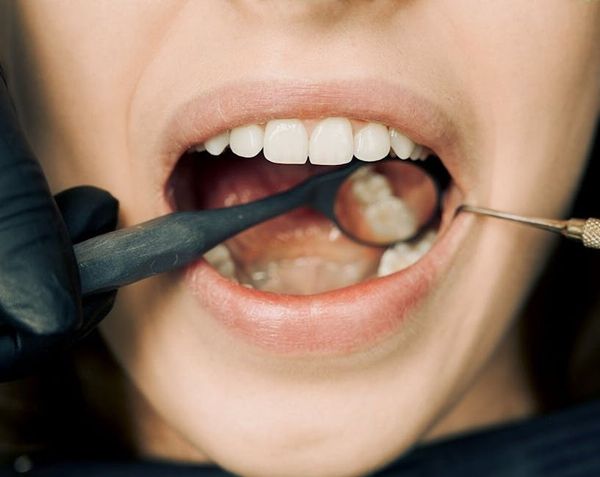 פרופיל של דוקטור: מהו טיפול שיניים פרוטטי