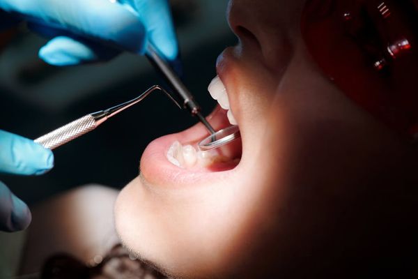 מבריק השיניים: סיפורו של מנקה שיניים תותבות